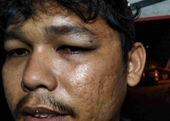 Dugaan Penganiayaan Nasabah Bank Pelat Merah Dilaporkan ke Polisi