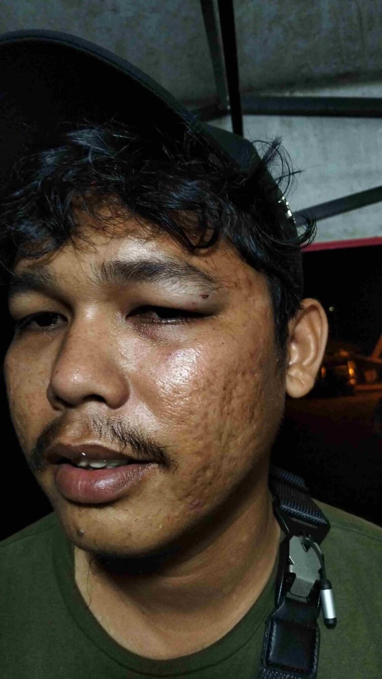 Dugaan Penganiayaan Nasabah Bank Pelat Merah Dilaporkan ke Polisi