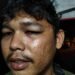 Dugaan Penganiayaan Nasabah Bank Pelat Merah Dilaporkan ke Polisi
